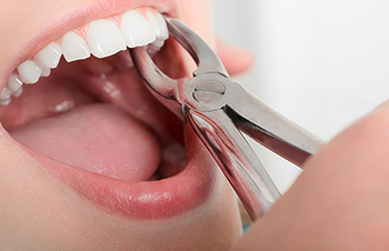 Keysborough Dental Surgery Melbourne